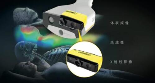 康耐視3D-A5060三維面陣視覺系統(tǒng)助力精準放療，實現(xiàn)人體定位監(jiān)控新維度(圖1)