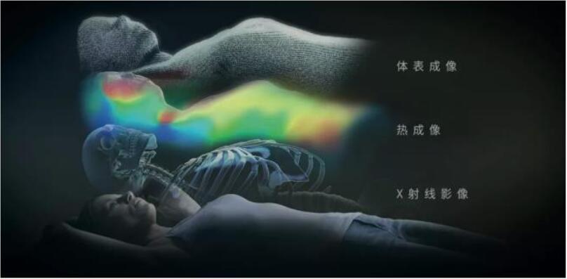 康耐視3D-A5060三維面陣視覺系統(tǒng)助力精準放療，實現(xiàn)人體定位監(jiān)控新維度(圖3)